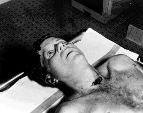 John F Kennedy muerto